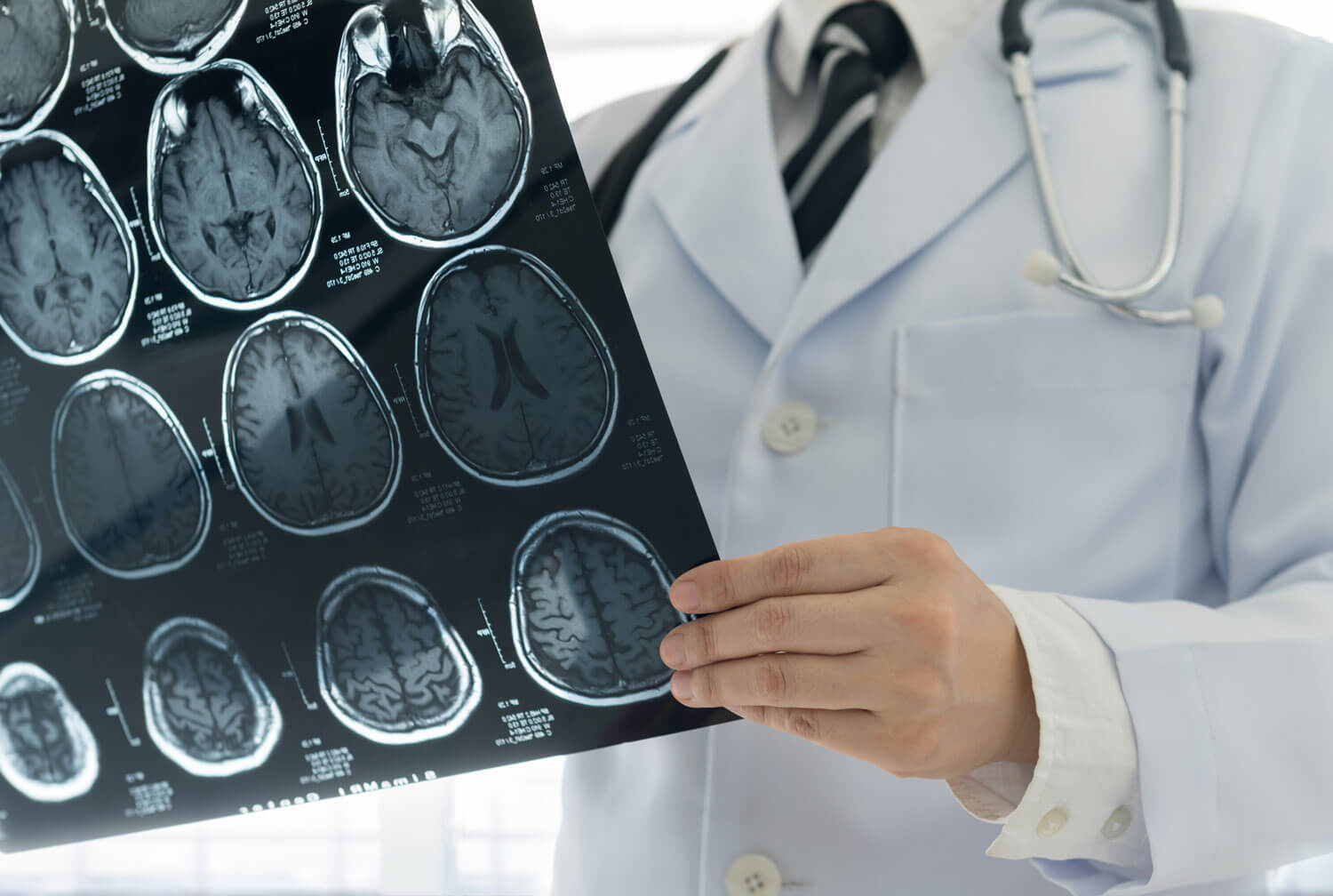 neurology